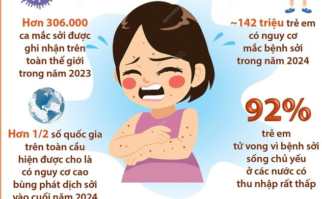 Tổ chức Y tế Thế giới cảnh báo sự lây lan nhanh chóng của bệnh sởi