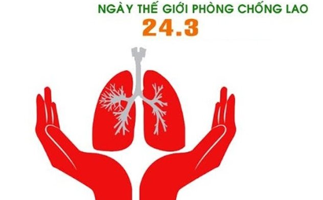 Những điều cần biết về bệnh Lao