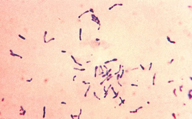 Phát hiện thêm một ca bạch hầu ở Bắc Giang