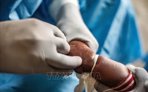 Chuyên gia Thái Lan khuyến nghị về vaccine phòng ngừa đậu mùa khỉ